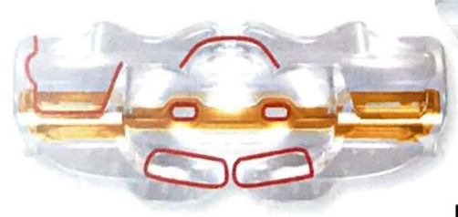 Myobrace B2, Myobrace para braquets fase 2 tamaño grande